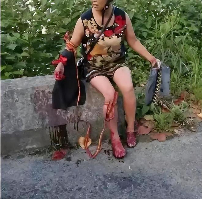 身亡！身材一绝是家中独生女肤白貌美太可惜pg电子模拟器免费版27岁女游客被蛇咬(图15)